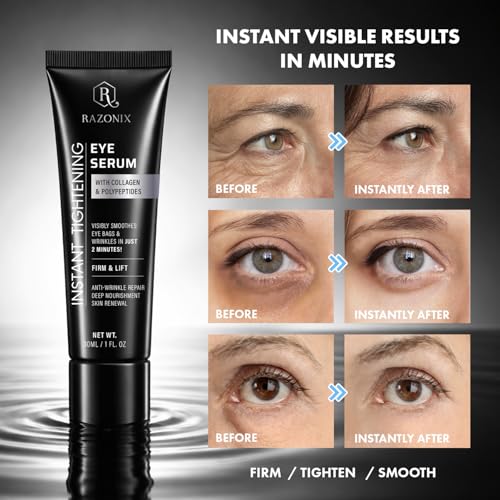 RAZONIX Instant Eye Tightening and Lifting Serum for Under Eye Bags, Puffiness, Dark Circles, and Hooded, Droopy Eyelids, with Caffeine and Hyaluronic Acid for Women & Men