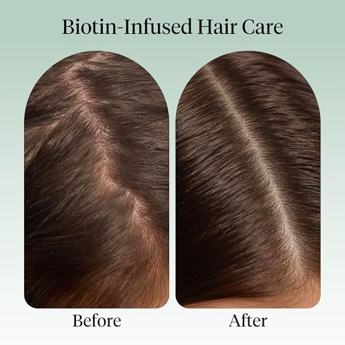 Kitsch Rosemary Oil for Hair Growth -With Castor Oil, Biotin & Jojoba- 10mL