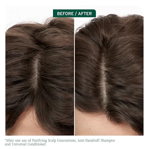 Biolage Scalp Sync Purifying Concentrate – For All Scalp Types, 6.8 Fl Oz