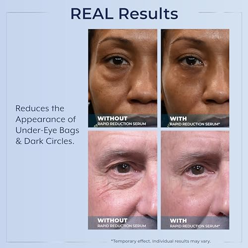 Plexaderm Eye Serum Pump - Visibly Reduces Bags, Wrinkles & Dark Circles