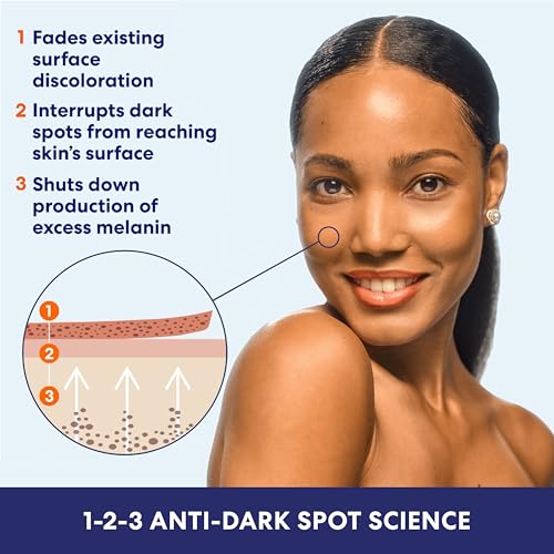 Palmer's Skin Success Body Lotion, Anti-Dark Spot Fade Milk (8.5 Oz)