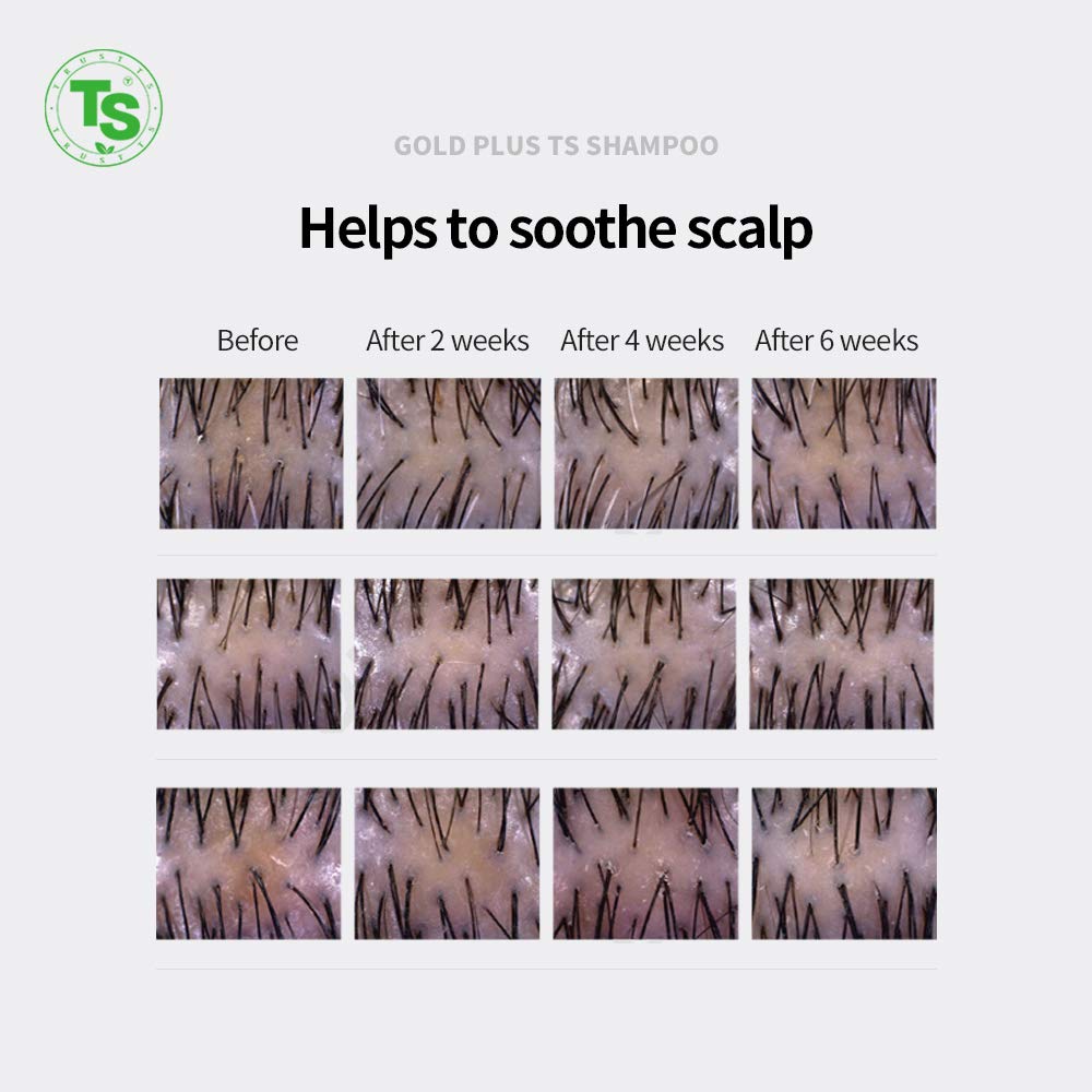 Gold Plus TS Shampoo for Hair Growth & Thickness(16.9 Fl Oz) Luxury Gold Biotin Ingredients | For Damaged, Dry, Thin Hair | Silicone Free ([SET])
