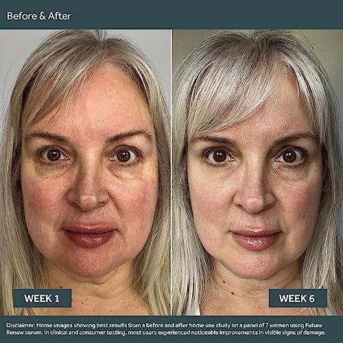 No7 Future Renew Damage Reversal Skincare Set - Anti Aging Face Serum (.33 Fl Oz), Day Cream with SPF 25 (1.69 Fl Oz) & Night Cream (1.69 Fl Oz) - Reverses Visible Signs of Sun Damage - 3-Piece Set