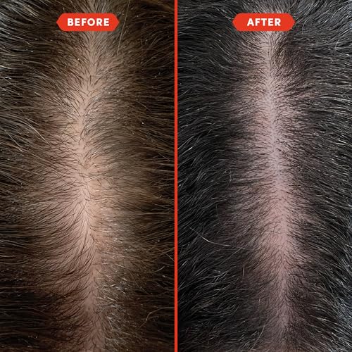 Fable and Mane Hair Oil - HoliRoots Strengthening Serum for Damaged, Frizzy Hair with Amla, Castor Oil for Hair Health - 3.4FL oz