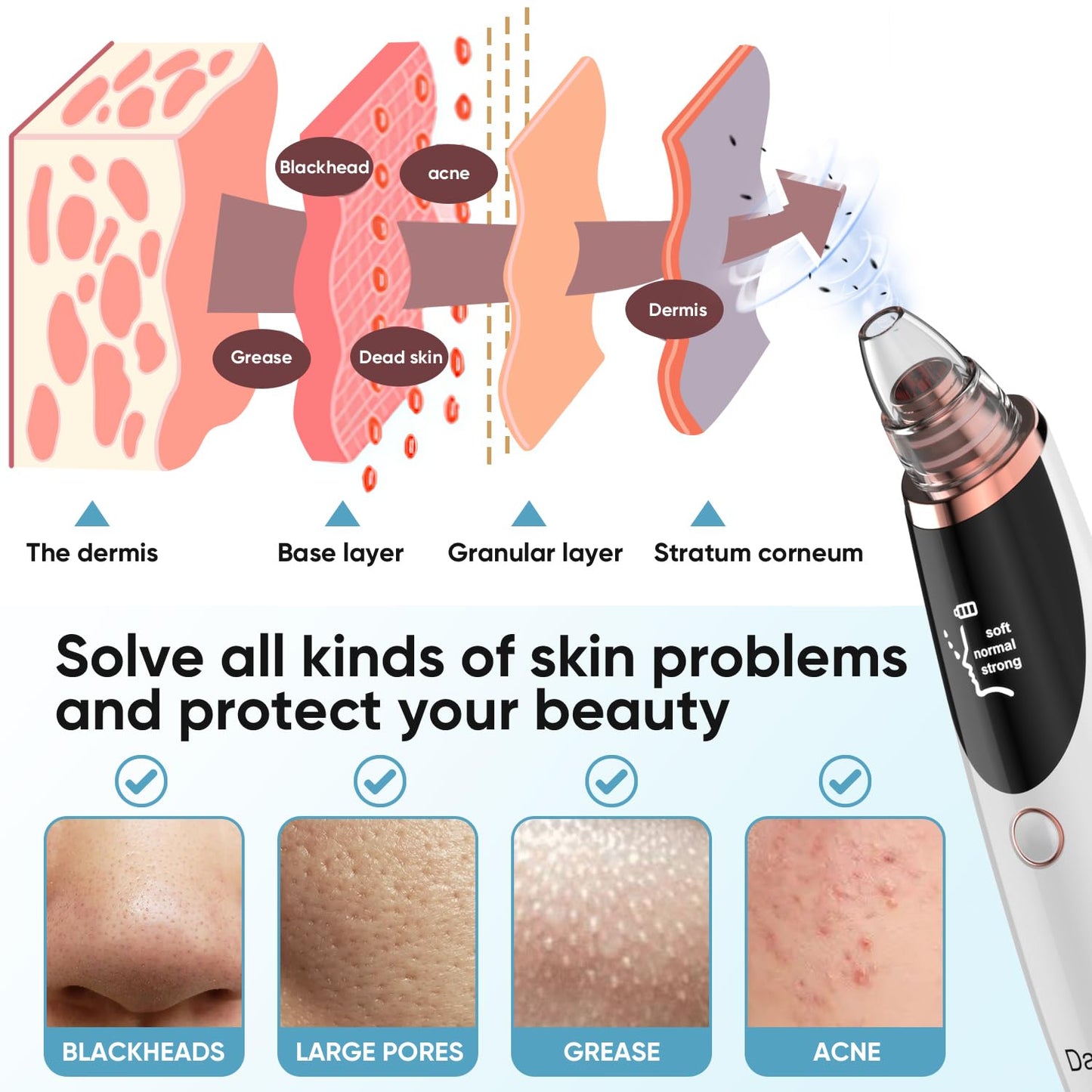 Daweir Blackhead Remover Pore Vacuum - Pimple Extractor Tools Pore Cleaner toolfor Face & Nose