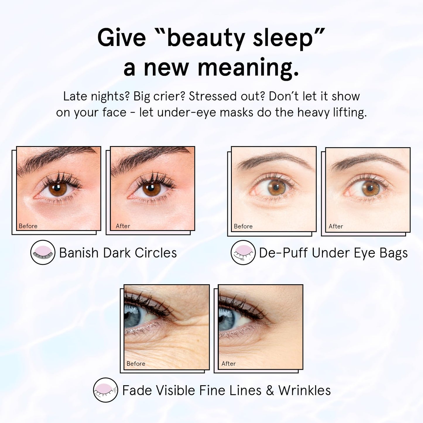grace & stella Purple Eye Treatment Gels - Dermatologist Tested - Under Eye Masks With Retinol - Restoring Under Eye Patches for Puffy Eyes and Dark Circles - Vegan, Cruelty-Free, 24 Pairs