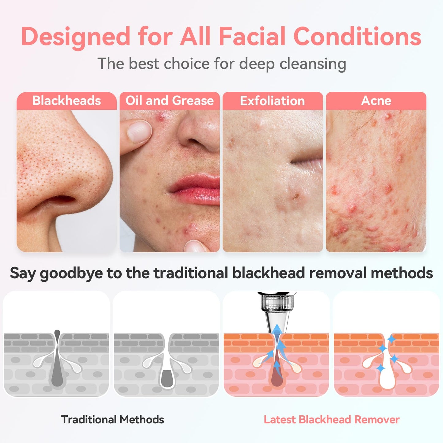 Newest Blackhead Remover Pore Vacuum Upgraded Facial Pore Cleaner Electric Comedone Whitehead Extractor Tool-5 Suction Power,5 Probes,USB Rechargeable Blackhead Vacuum Kit for Women & Men