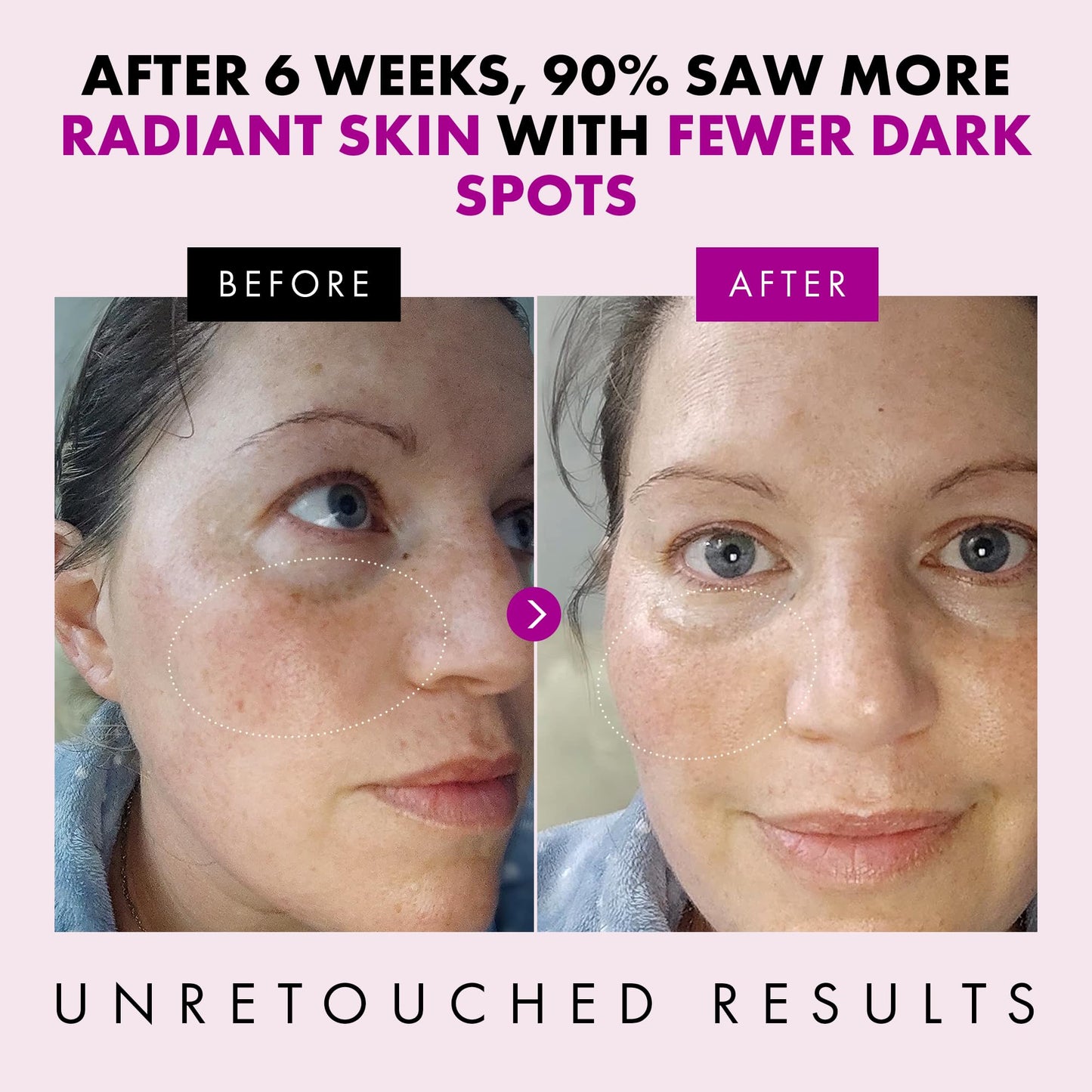 Collagen Anti Aging Face Cream with Patented Matrixyl-3000 & Argireline - 5x More Powerful w/ Pep-Boost Peptide Complex + 10 Antioxidants - Facial Wrinkle Day/Night Cream Face Moisturizer for Women